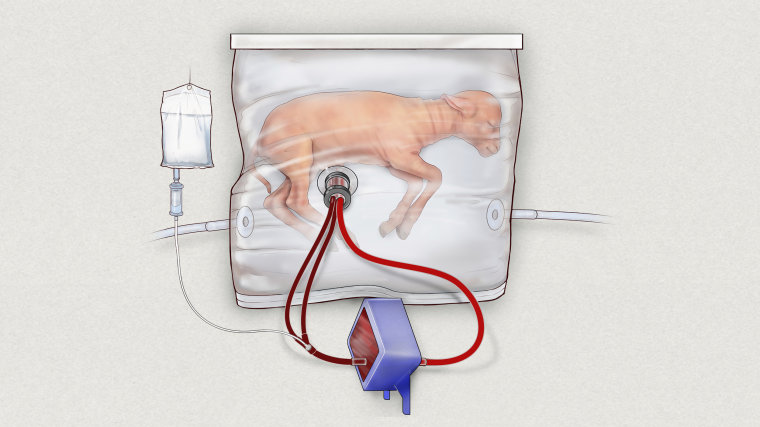 Image: An illustration of a fluid-filled incubation system that mimics a mother's womb