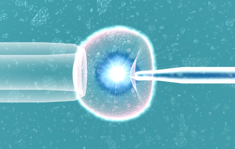 In vitro fertilization