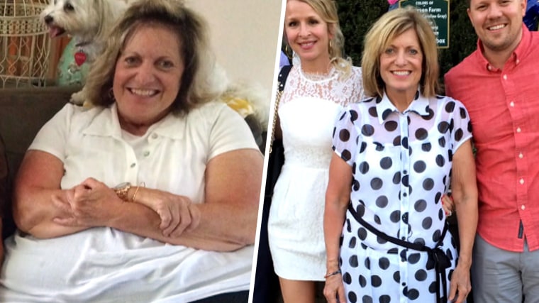 Mom inspired by Al Roker loses 165 lbs.