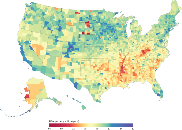 Image: Life Expectancy at Birth by County, 2014