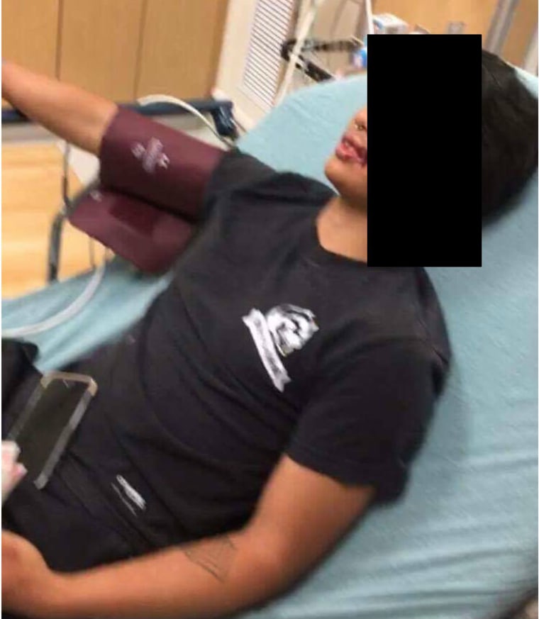 A Vietnamese-American college student was admitted to the emergency room after an encounter at the OC Night Market, May 2017. This photo was provided by the student, who wishes to remain anonymous.