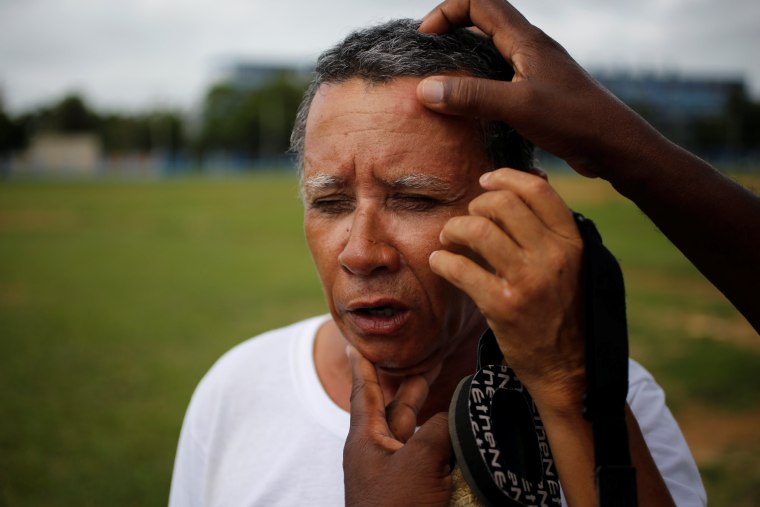 Image: Eugenio Oquendo, who is visually impaired, is checked for injuries after a fellow player fell on him during a baseball lesson at the Changa Medero stadium, in Havana