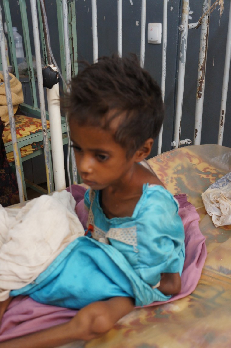 The malnourished six-year-old weighs only 15 pounds.