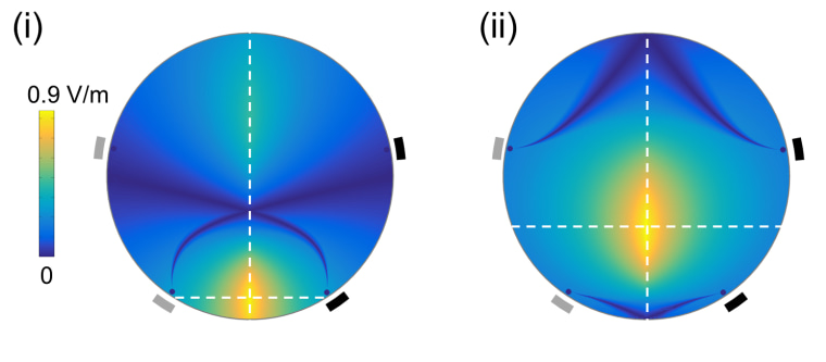 Image: Representation of TI stimulation