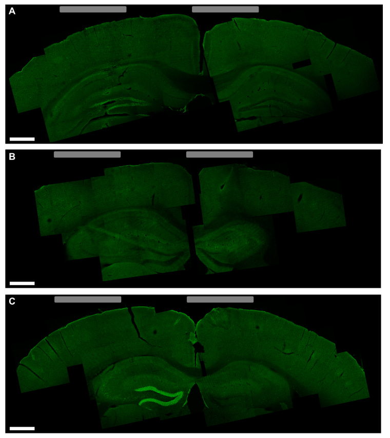 Image: An activated area in the mouse brain