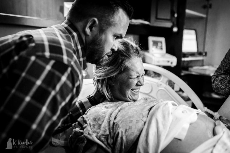 Rausch believes that her contractions being slowed by an epidural, in combination with an hour of pushing, caused her son's misshapen head.