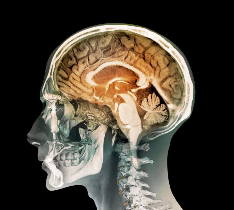 Image: Human Head, MRI and 3D CT scans