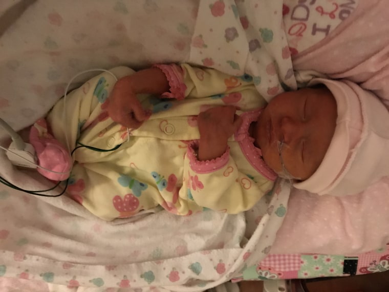 Baby Ruby in the hospital after the emergency c-section that saved her life.