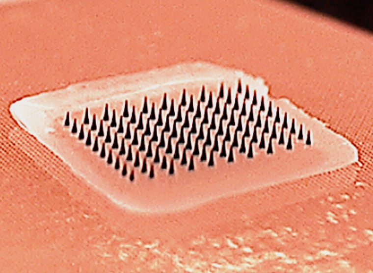 Image: Microneedle influenza vaccine