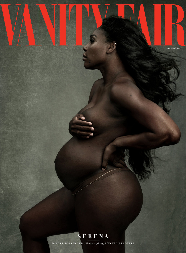 Image: A pregnant Serena Williams poses in a Vanity Fair cover photograph