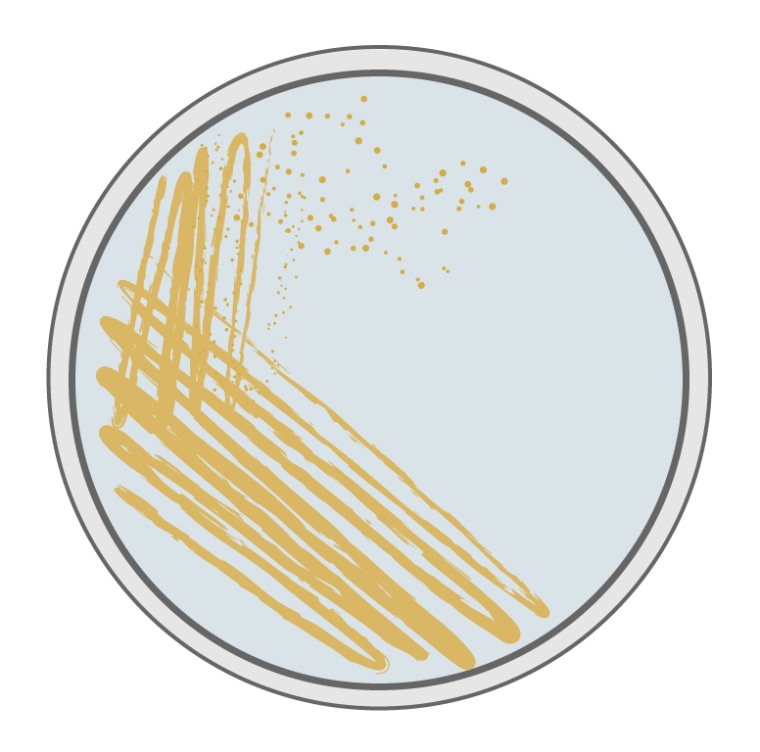 Eczema patients had more Staphylococcus aureus bacteria (golden colonies) on their skin during active flare-ups.