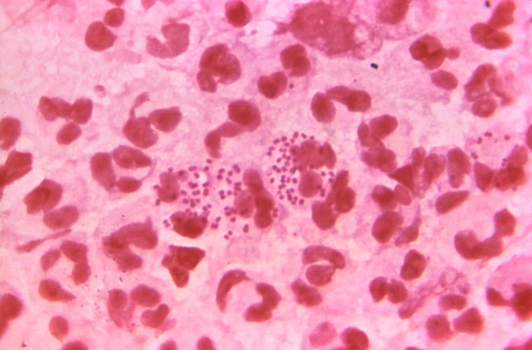 Image: Neisseria gonorrhoeae diplococcal bacteria