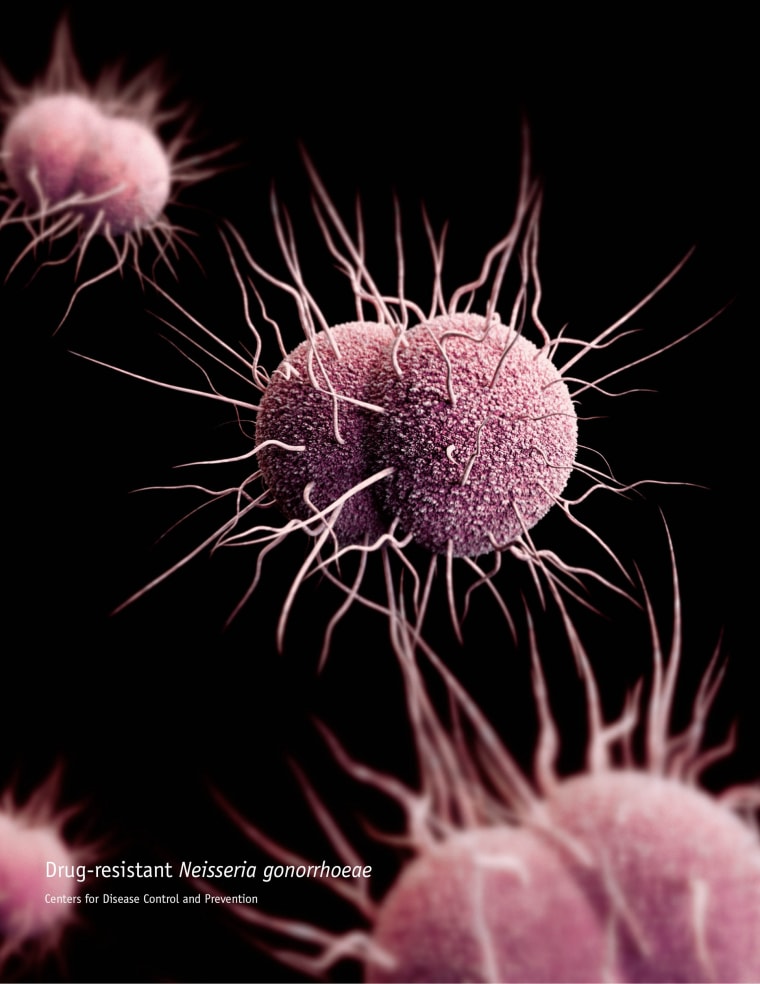 Image: drug-resistant Neisseria gonorrhoeae diplococcal bacteria