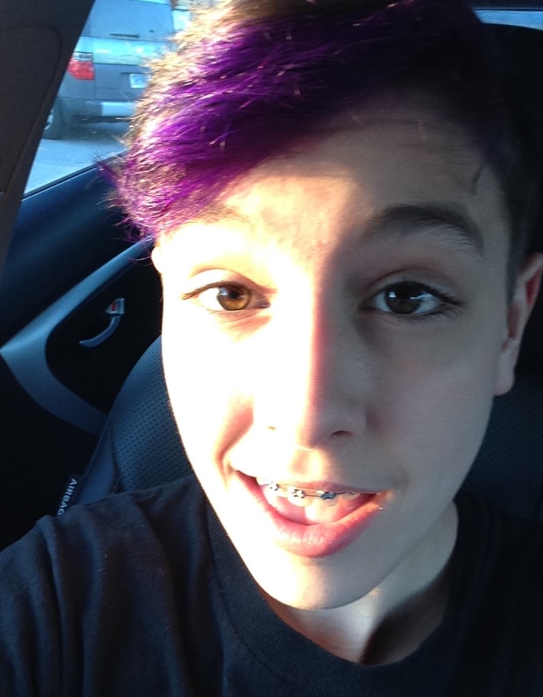 Kim Jester's son, Jimmy, 14, with his colored hair.