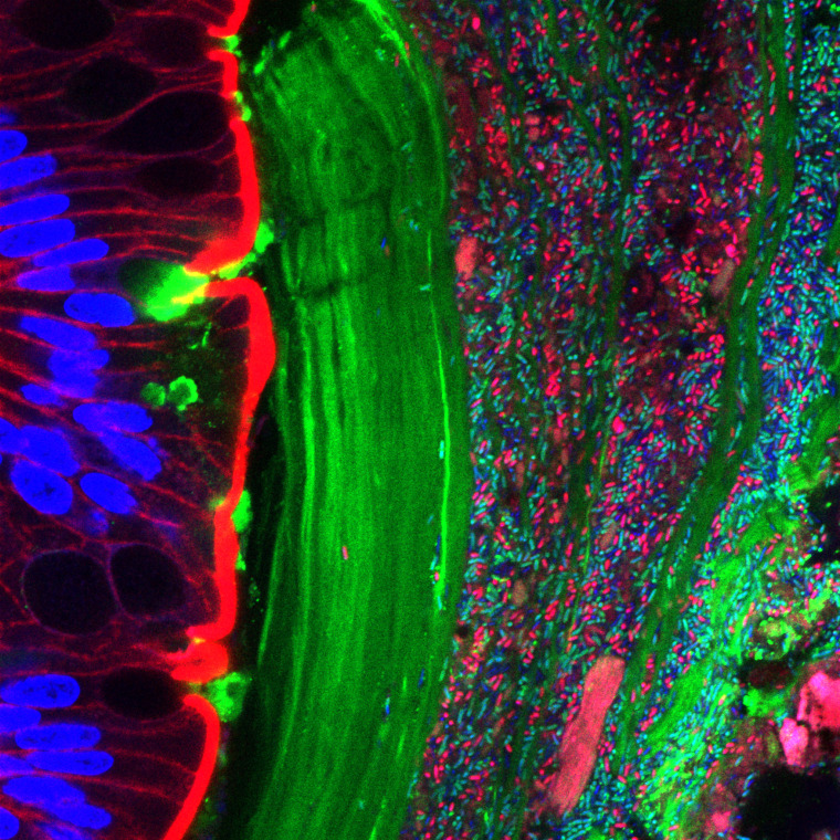 Bacteroides thetaiotaomicron, a prominent gut symbiont, expressing green- or red-fluorescent protein, within the colon. Blue ovals on left are nuclei of colon cells, green margin between colon cells and bacteria is mucus.