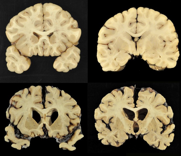 Image: Sections of brain