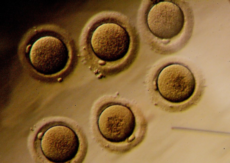 Human embryos on a petri dish are viewed through a microscop