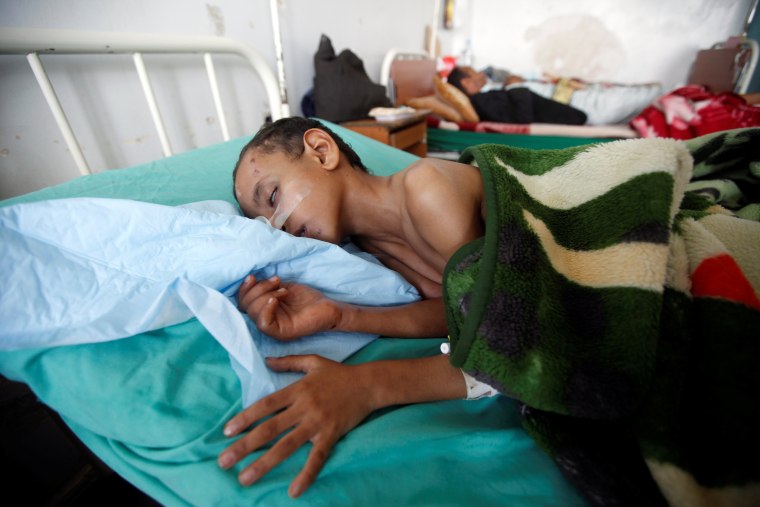 Image: A boy lies on a bed of a hospital in Sanaa, Yemen.