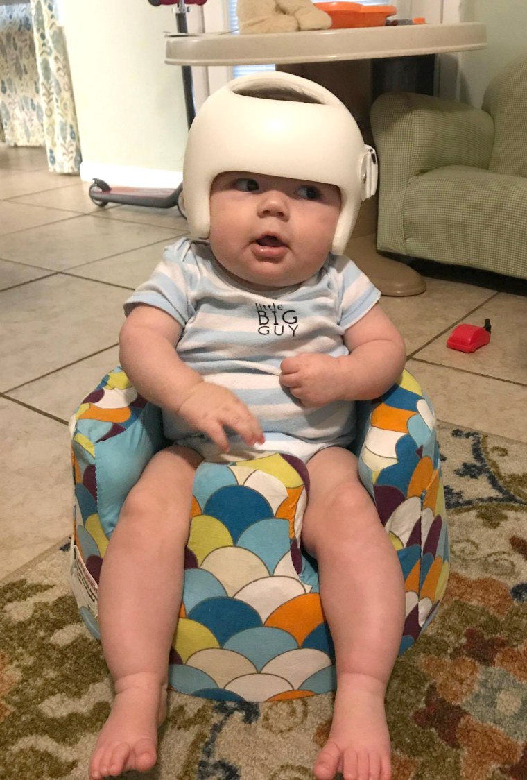 Family wears helmets in solidarity with 4-month-old baby diagnosed with plagiocephaly