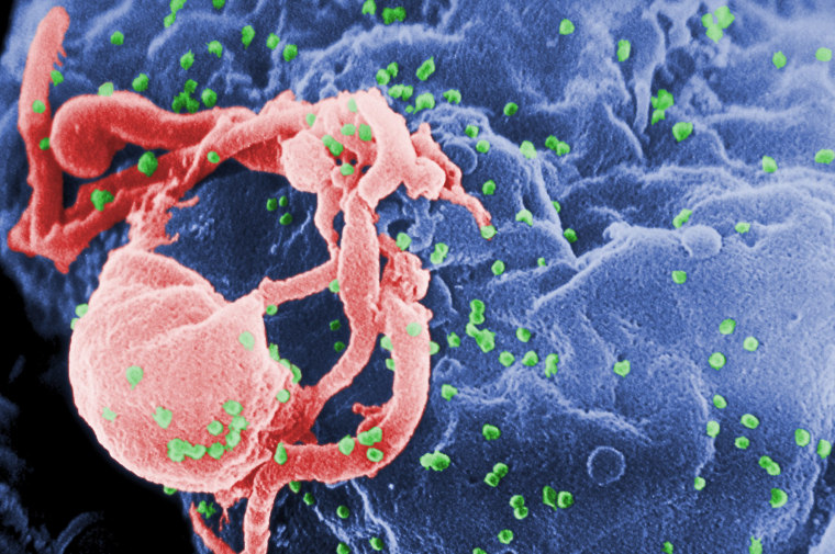 Image: Scanning electron micrograph of multiple round bumps of the HIV-1 virus on a cell surface.