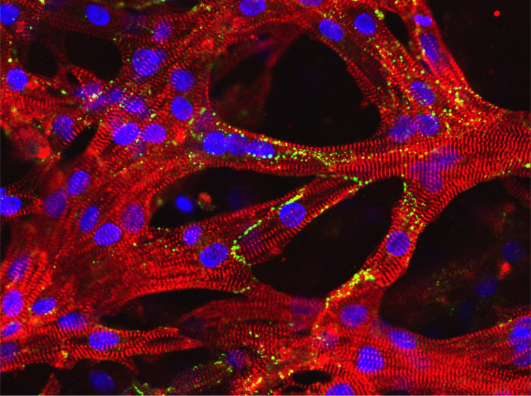 The heart muscle patch seen through a microscope. The striped patterns are muscle fibers, the large blue dots are proteins, and the green dots represent patterns of electrical signalling.