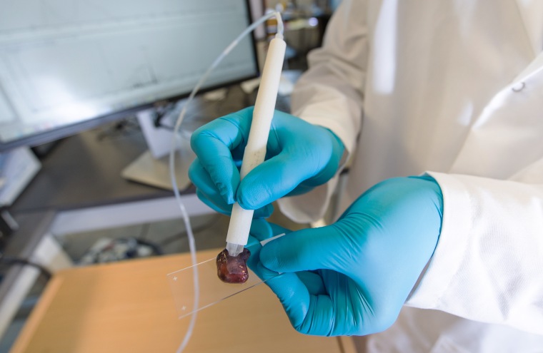 Image: The MasSpec Pen is a handheld probe that can non-destructively analyze human tissue samples to identify cancer
