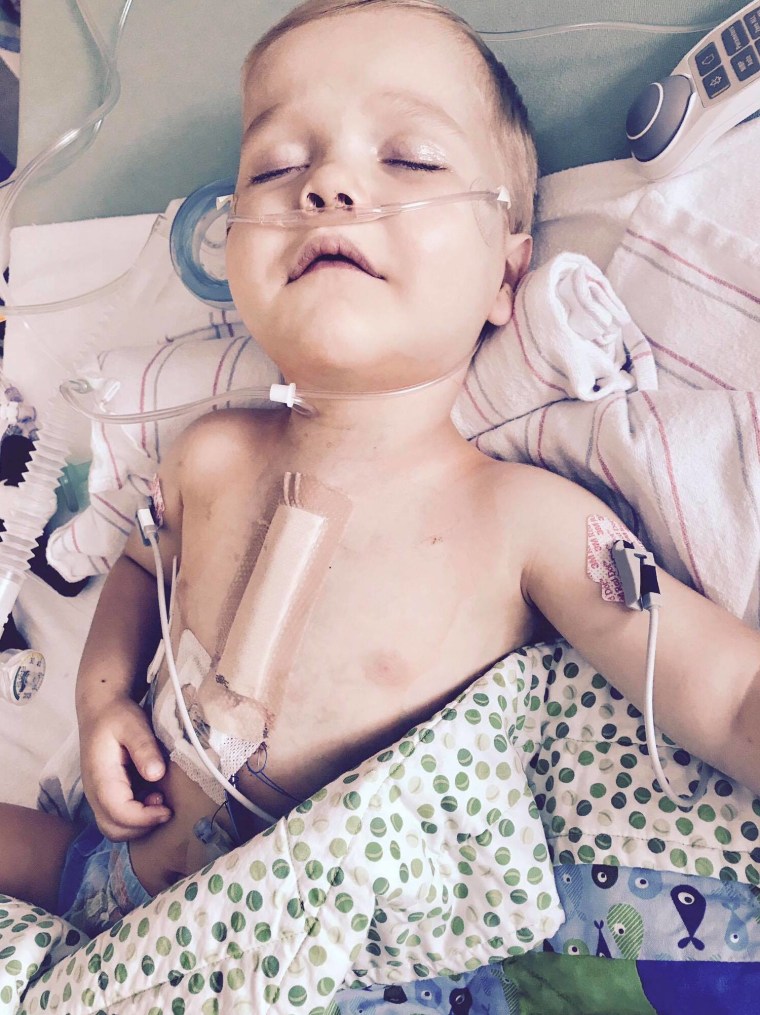 In his short life, Finn Blumenthal has had 14 procedures, 12 surgeries, and 2 open heart surgeries.
