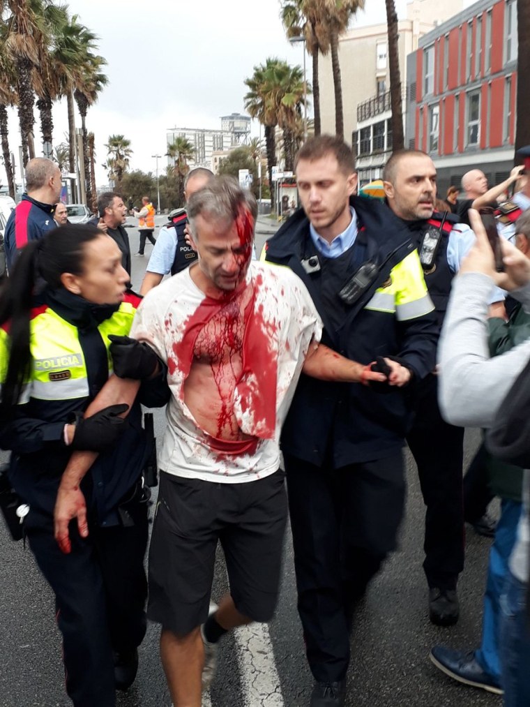 Image: A man injured in clashes with Spanish armed police is escorted away by Catalan officers in Barcelona.