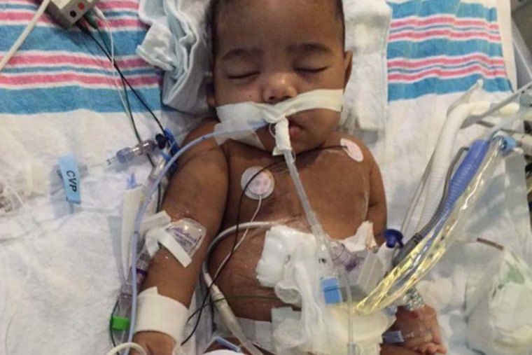 Carmellia Burgess' son, Anthony, was born without kidneys.