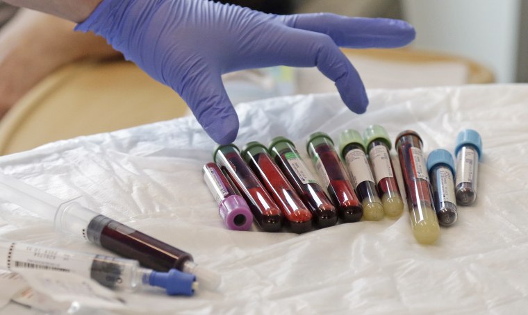 Blood samples taken from a patient receiving CAR-T cell therapy at the Fred Hutchinson Cancer Research Center in Seattle.