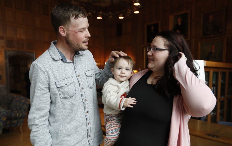 Lilly Ross, right, holds her 17-month-old son Leonard as she talks with face transplant recipient Andy Sandness, left, after their first meeting at the Mayo Clinic, Friday, Oct. 27, 2017, in Rochester, Minn.