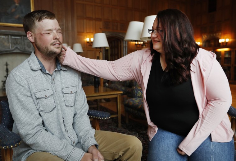 Lilly Ross, right, holds her 17-month-old son Leonard as she talks with face transplant recipient Andy Sandness, left, after their first meeting at the Mayo Clinic, Friday, Oct. 27, 2017, in Rochester, Minn.