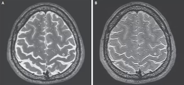 Image: Brain scan