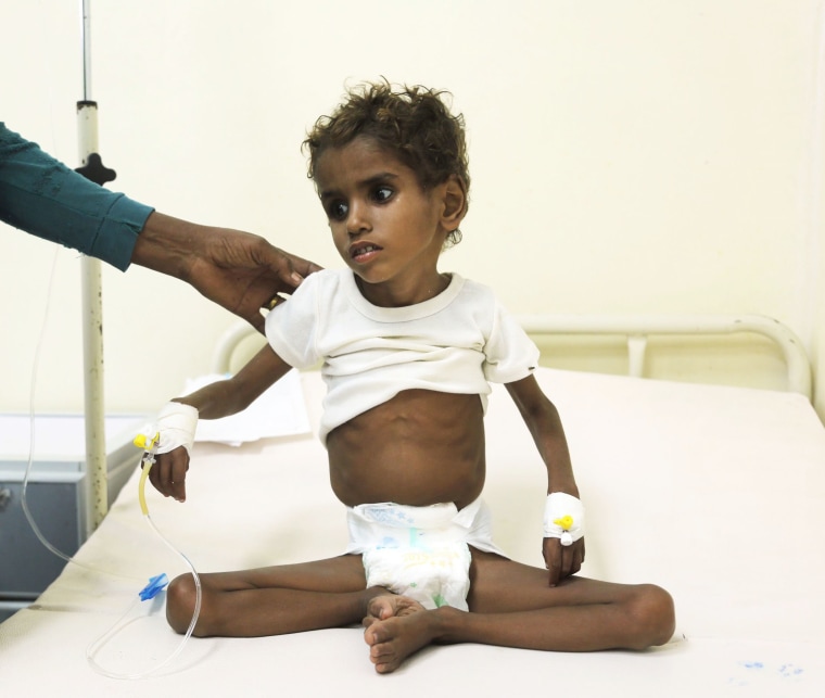 Image: Yemen Conflict