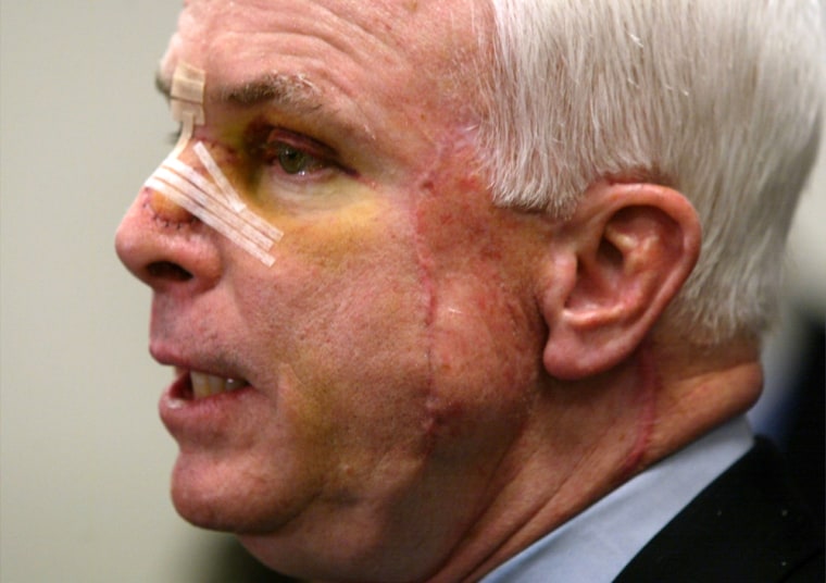 Image: McCain wears a bandage on his nose after skin cancer surgery