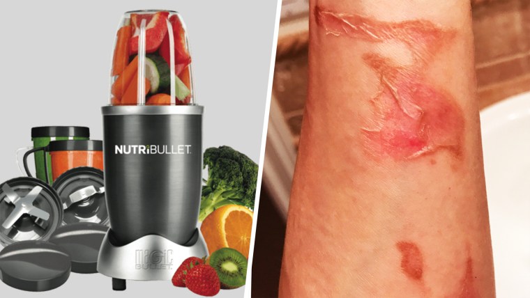 Magic Bullet Lawsuit  Injured by a Magic Bullet Explosion?