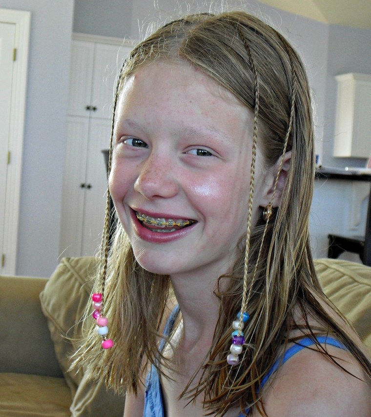 Sarah Pennington, a teen who suffers from trichotillomania, a hair pulling disorder.