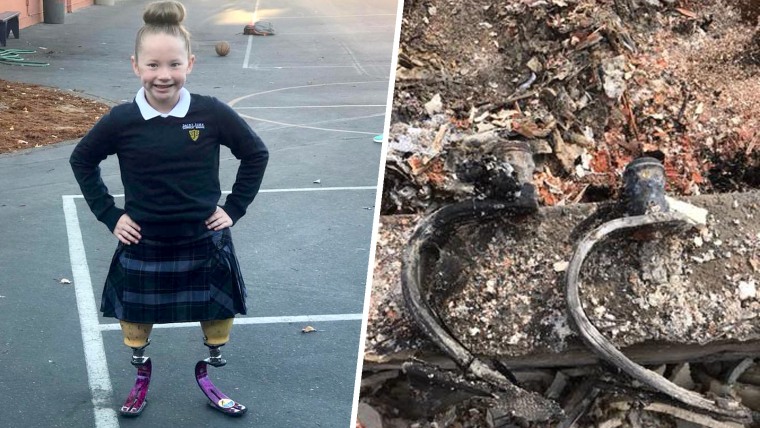 10-year-old who lost her prosthetic legs in her mom's home, which was burned down in the Tubbs fire earlier this year.