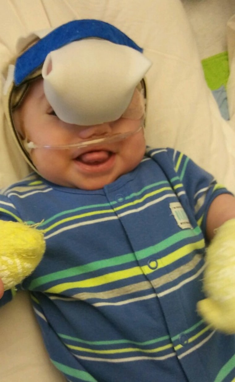 Zak Riegel was born with an encephalocele, a rare birth defect