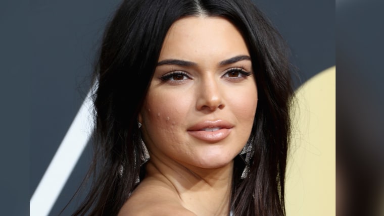 Kendall Jenner acne