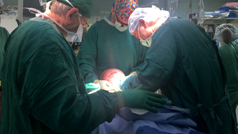 In a 12-hour surgery, doctors removed a 10 pound tumor from 14-year-old Emanuel Zayas face.