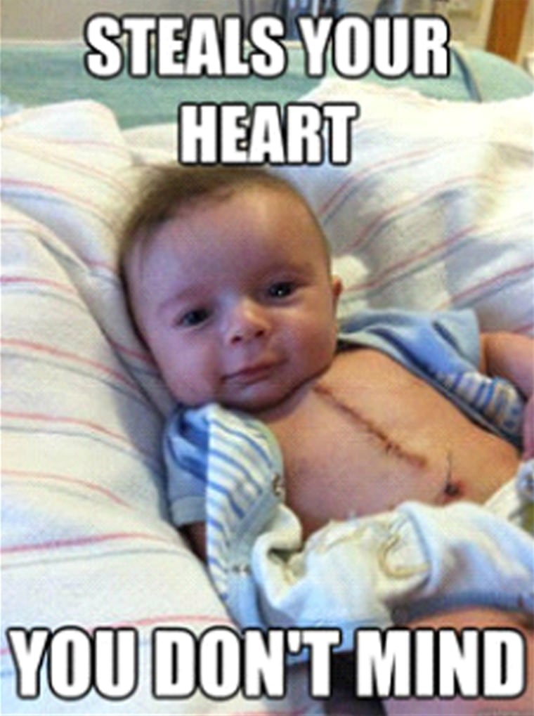 Joey Powling, the baby who became a meme when he had heart surgery as an infant.