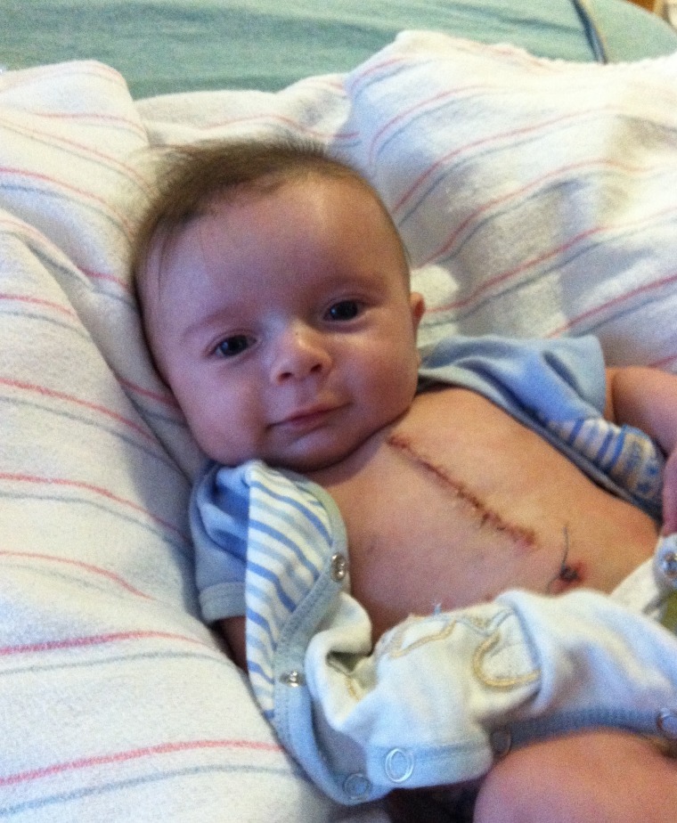 Joey Powling was diagnosed with a congenital heart defect in utero, and had surgery at three months old to repair his heart.