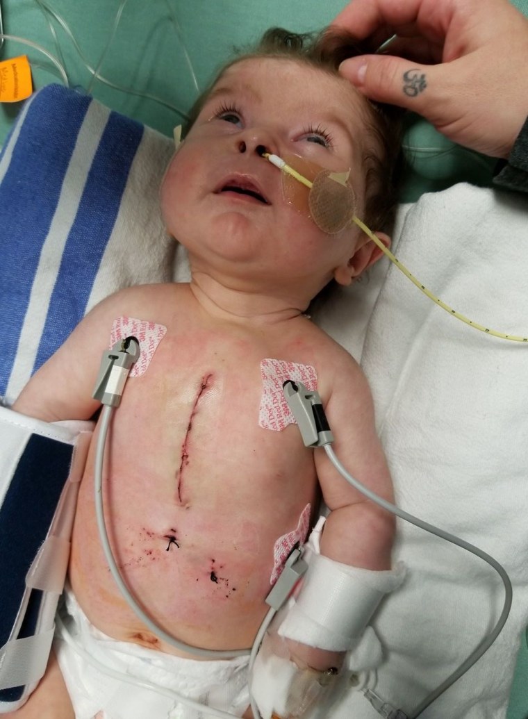 "My 8-week-old warrior queen, Charli Leventhal," said Monica Leventhal. "Ventricular septal defect repair just this past Wednesday. Crushing it here at Children's Hospital of Philadelphia! Prayers to all of your warriors."