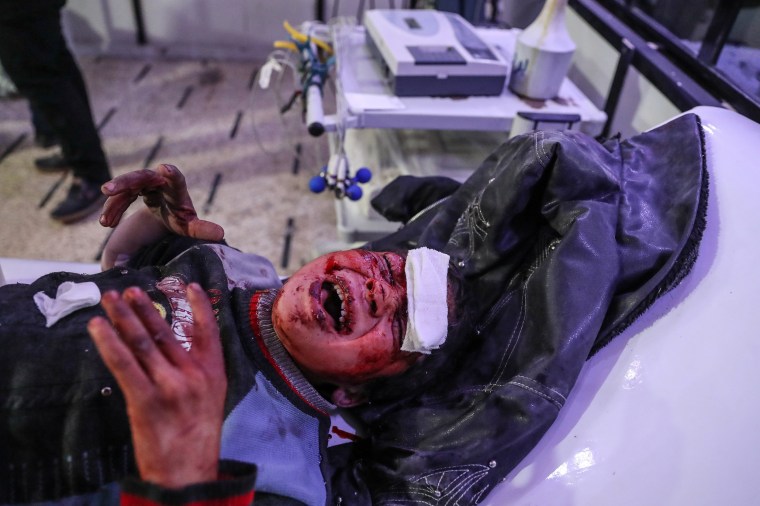 An injured child cries out while being treated for his injuries on Feb. 19.