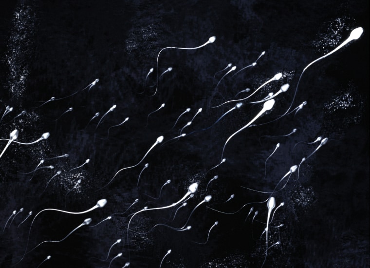Sperm all swimming in one direction.
