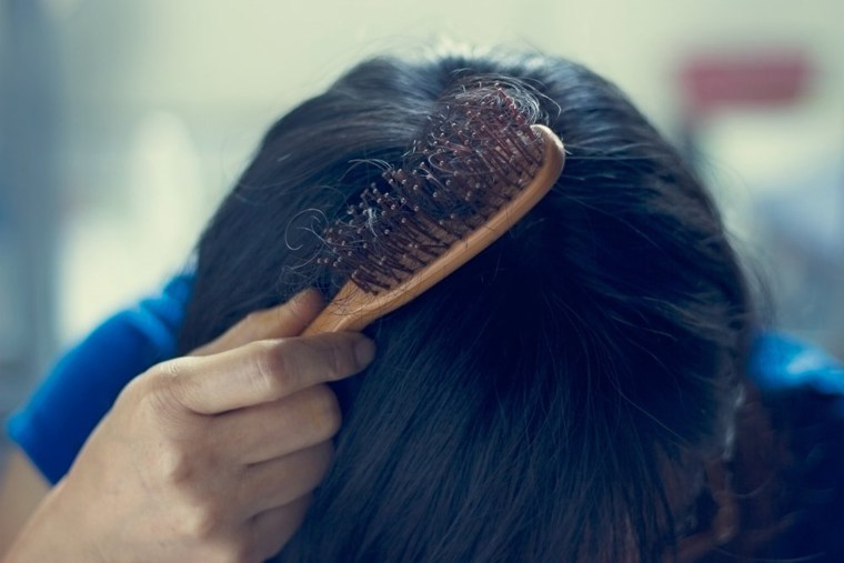 Why is my hair falling out 10 causes of hair loss