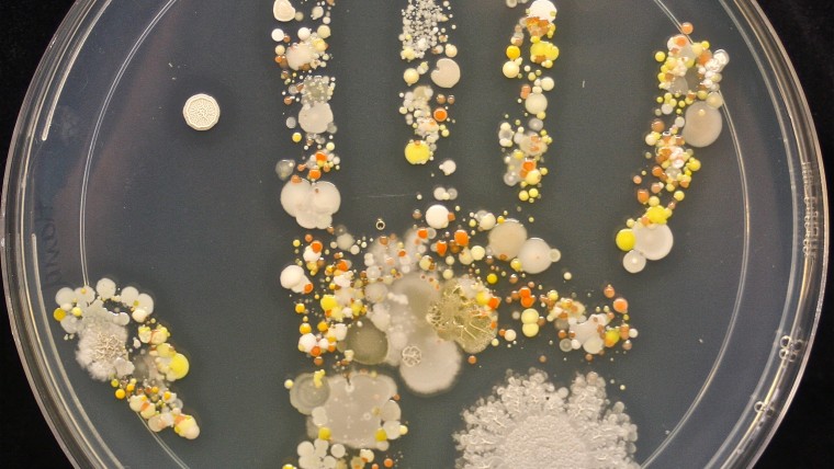 Tasha Sturm took a photo of her 8-year-old son's handprint on a Petri dish