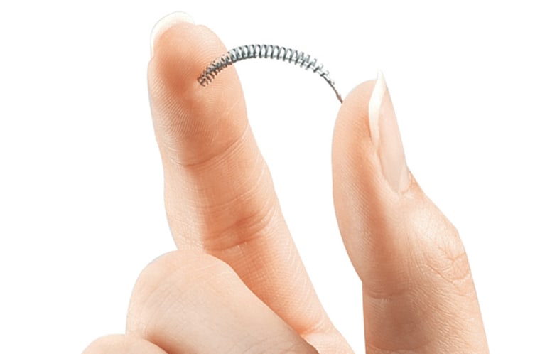 Image: Bayer's birth control implant Essure