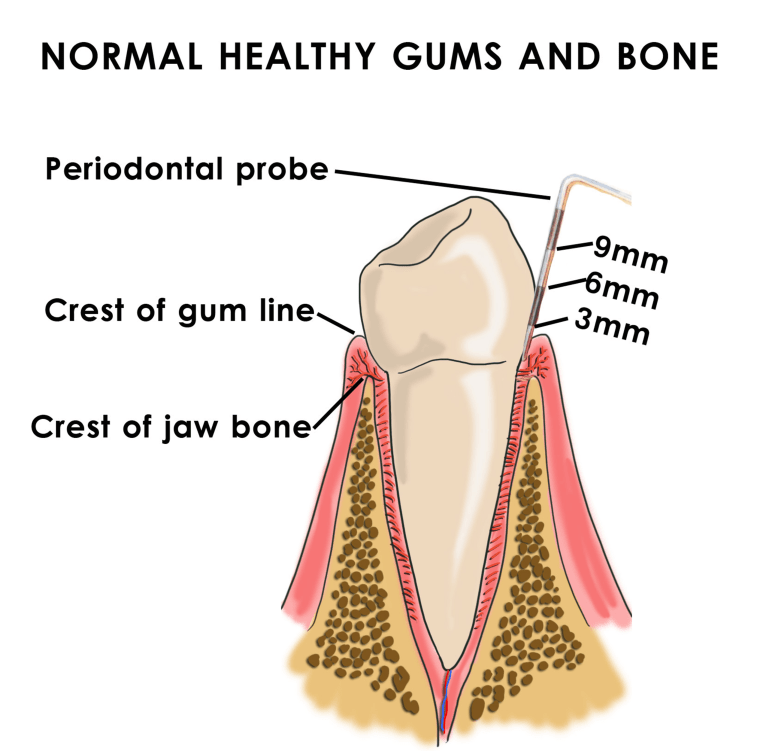 Dental Hygienist Explains Deep Cleaning Procedure 